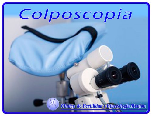 Colposcopia