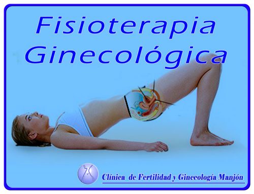 Fisioterapia Ginecológica